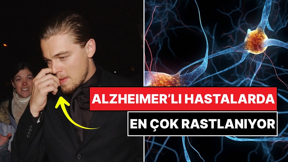 Basit Ama Önemli: Burun Karıştırmak ve Alzheimer Arasında Bağlantı Keşfedildi