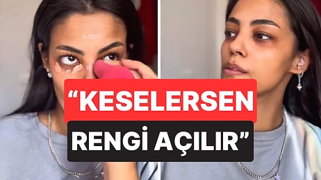 Esmer Olduğu İçin Küçükken Zorbalandığını Dile Getiren Kadın O Sancılı Süreci Anlattı