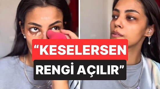 Esmer Olduğu İçin Küçükken Zorbalandığını Dile Getiren Kadın O Sancılı Süreci Anlattı