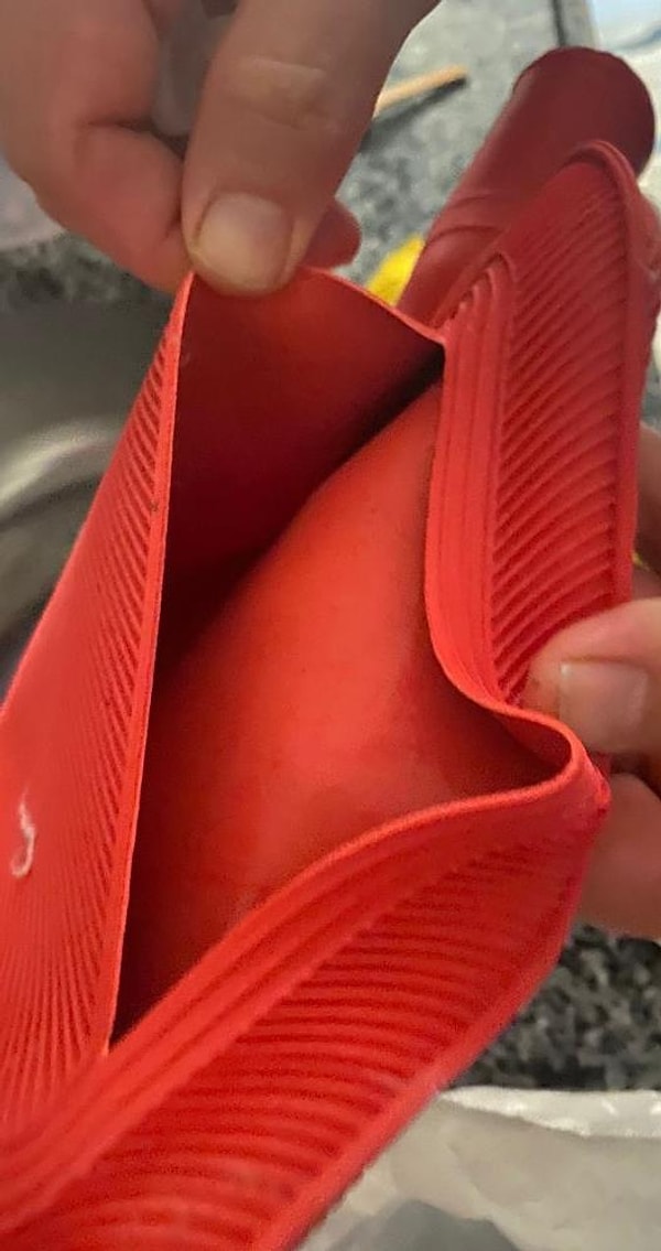 İstanbul'da yaşayan 23 yaşındaki Cansu Yılmaz'ın iddiaya göre 26 Kasım gecesi saat. 01.00'de ailesiyle evinde oturduğu sırada karnına koyduğu su torbası patladı.