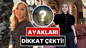 Arzu Sabancı'dan Son Pozundaki Yamulmuş Ayaklarını Fark Eden Kullanıcıya Jet Hızında Açıklama!