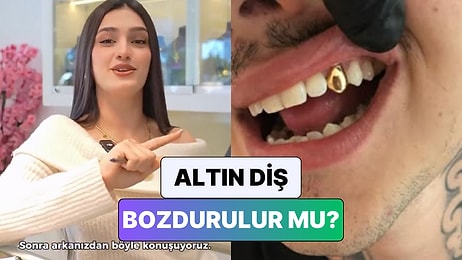 Bir Kuyumcu Merak Edilen O Soruyu Yanıtladı: "Siz Siz Olun Annenizin Altın Dişlerini Getirmeyin"