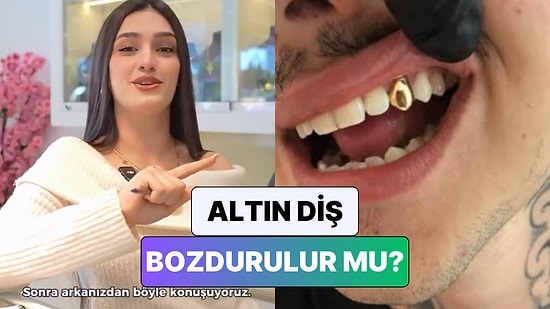 Bir Kuyumcu Merak Edilen O Soruyu Yanıtladı: "Siz Siz Olun Annenizin Altın Dişlerini Getirmeyin"