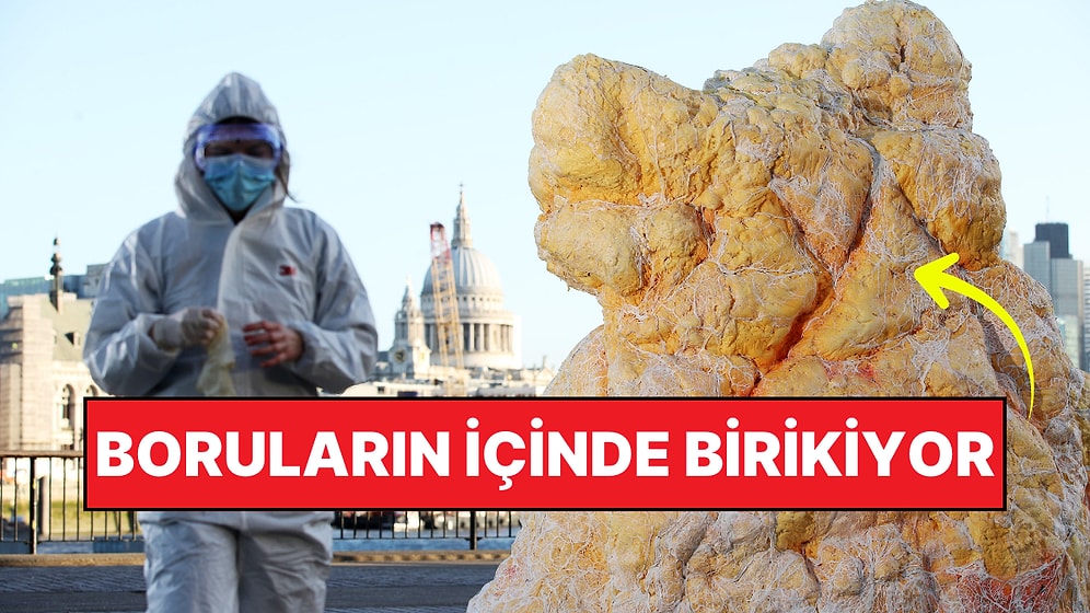 Uzmanlar Uyardı: "Mutfak Borularının İçinde Taş Oluşturuyor, Lavaboya Sakın Dökmeyin"