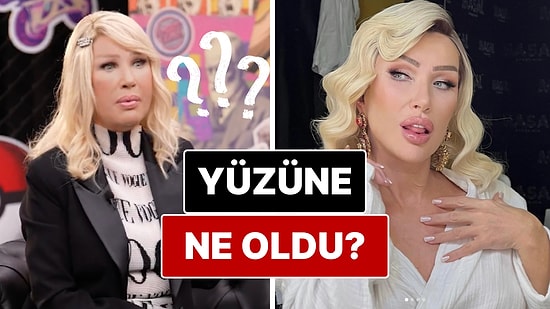 Yüzünün Son Haliyle Dikkat Çeken Seda Sayan'dan Eleştirilere Cevap!