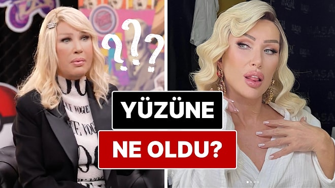 Yüzünün Son Haliyle Dikkat Çeken Seda Sayan'dan Eleştirilere Cevap!