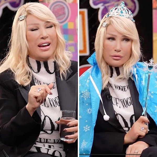 In recent days, the topic that has truly dominated the entertainment news is the "unusual swelling" on Seda Sayan's face during the episode where she was a guest on Enis Arıkan's show.