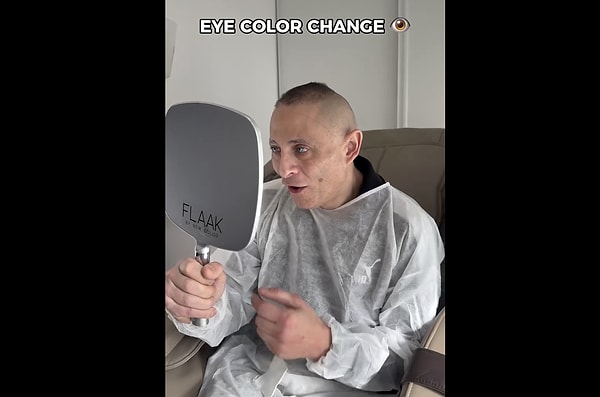 Göz rengi değiştirme operasyonu nasıl yapılır?