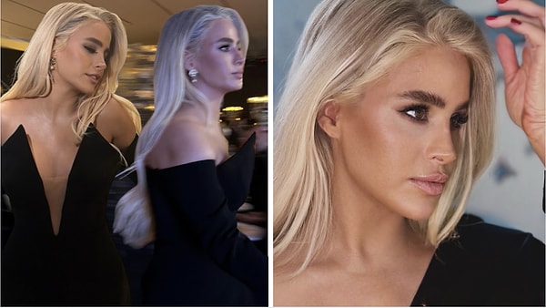 Son yıllarda Büşra Pekin, estetik görünümü ve dış görünüşündeki değişimlerle magazin gündeminde sıkça konuşuluyor.