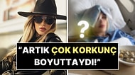 Göremediği İçin Kendini Yaraladığını Açıklayan Seren Serengil Akıllı Lens Ameliyatı Oldu!