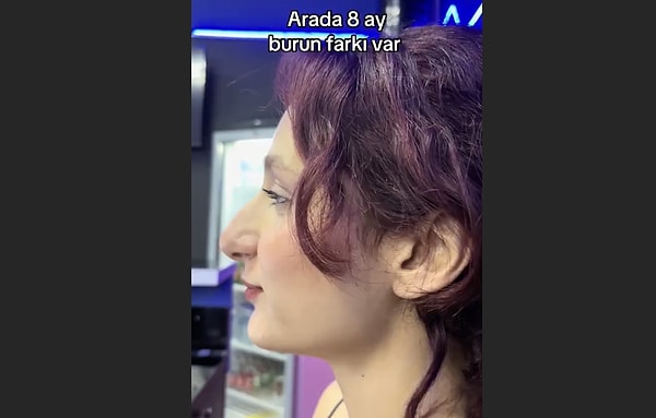 "Açı ile alakalı"