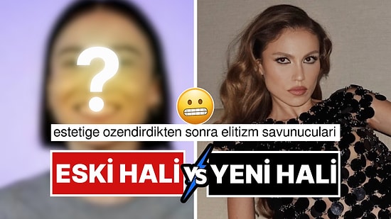 Duygu Özaslan'ın Estetikli Kadınlar Hakkındaki Açıklaması Akıllara Eski Halini Getirdi!