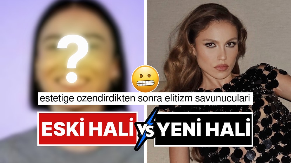 Duygu Özaslan'ın Estetikli Kadınlar Hakkındaki Açıklaması Akıllara Eski Halini Getirdi!