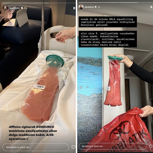 Yanlış bir popo ameliyatı geçiren Danla Bilic, dolgunun tüm vücuduna yayıldığını açıklamıştı.