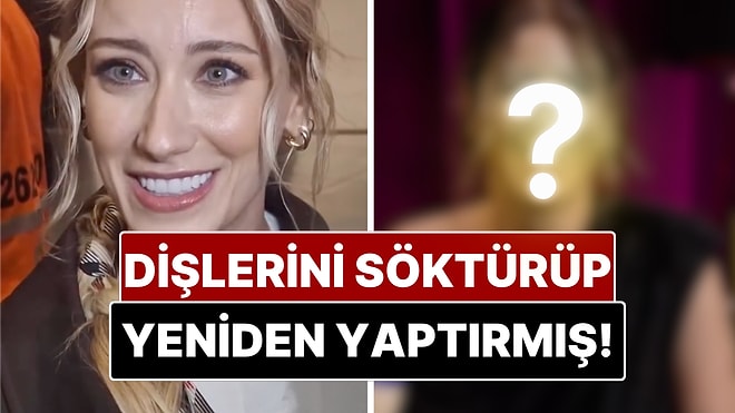 Dişlerine Yaptırdığı İşlemle Tanınmaz Hale Gelen Hazal Kaya'dan Radikal Karar