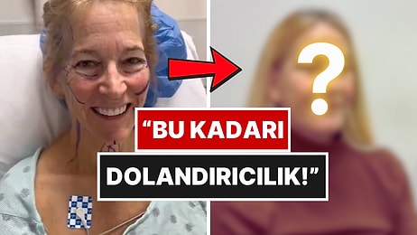 Estetik Operasyonla 20 Yaş Gençleşen Kadının Değişimi Görülmeye Değer!