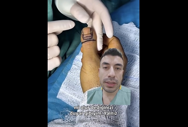 Peki nedir bu raket tırnak?