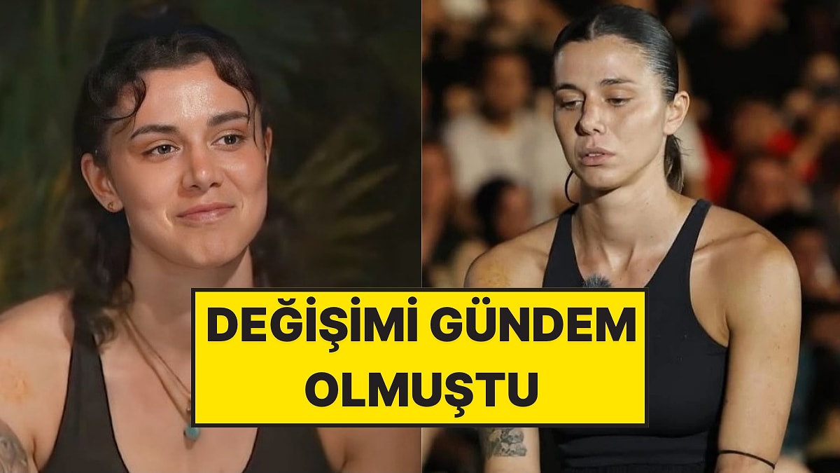 Değişimi Dikkat Çekmişti: Survivor Nefise’nin Estetiklerini Açıkladığı Anlar