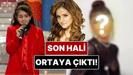“Didem” Şarkısıyla Tanınan Günel Zeynalova’nın Son Hali Dikkat Çekti