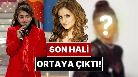 “Didem” Şarkısıyla Tanınan Günel Zeynalova’nın Son Hali Dikkat Çekti