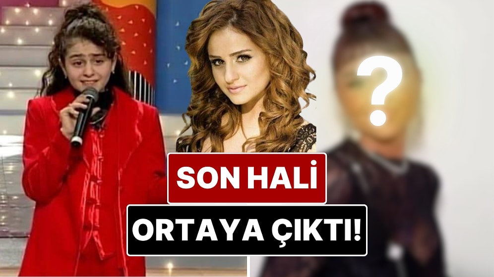 “Didem” Şarkısıyla Tanınan Günel Zeynalova’nın Son Hali Dikkat Çekti