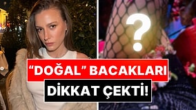Serenay Sarıkaya'nın Son Pozlarında "Fazlasıyla Doğal" Bacakları Dikkat Çekti!