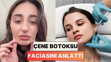 "İdrarımı Tutamadığım Bir Gün Oldu": Çene Botoksu Yaptıran Kadın Başına Gelenleri Anlattı