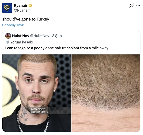 Bu kez aynı geceden farklı bir detay sosyal medyada gündem oldu.