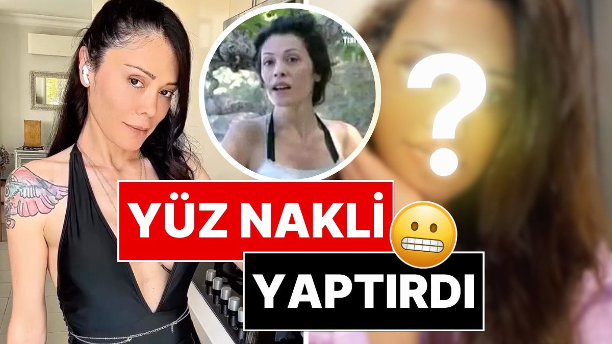 Eski Survivor Yarışmacısı Didem Ceran Kore'de Yüz Nakli Yaptırdı!