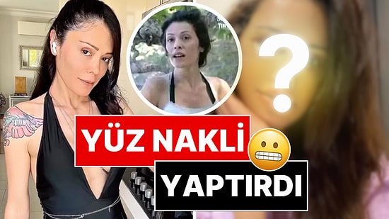 Eski Survivor Yarışmacısı Didem Ceran Kore'de Yüz Nakli Yaptırdı!