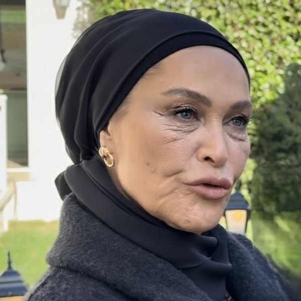 Aynı Yağmur Altında dizisinde Fazilet karakterine hayat veren Hülya Avşar'ın dizide filtre kullanıp kullanmayacağı merak ediliyordu.