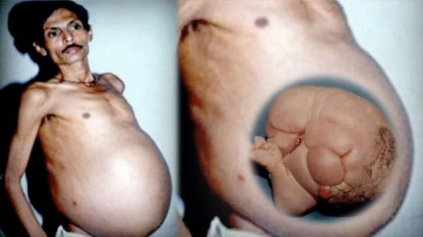 Ameliyathane kapısı açıldığında tablo tamamen değişti