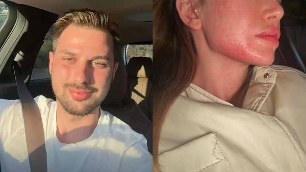 Görülen duruşmada tutuksuz sanık Berk Çetin mahkeme salonunda hazır bulunurken, Danla Bilic duruşmaya katılmadı.