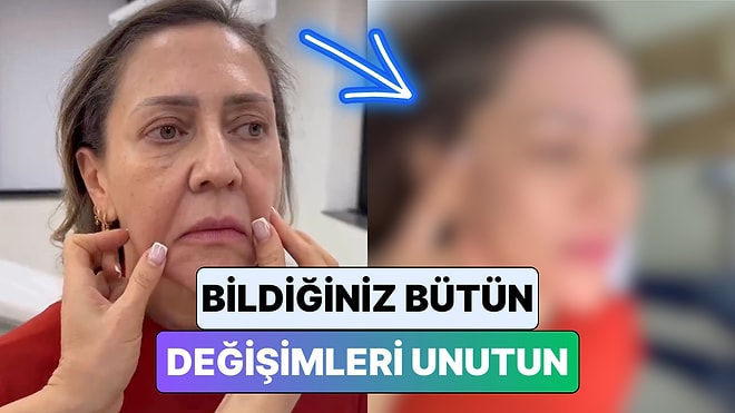 Bildiğiniz Bütün Değişimleri Unutun: Bir Kadın Geçirdiği Yüz Germe Operasyonu ile 20 Yaş Birden Gençleşti