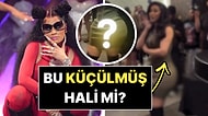 Dolgularını Eritip Poposunu Küçülttürdüğünü İddia Eden Cardi B'nin Son Hali!