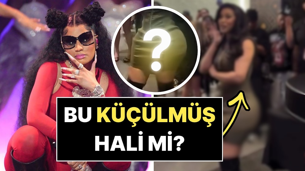 Dolgularını Eritip Poposunu Küçülttürdüğünü İddia Eden Cardi B'nin Son Hali!