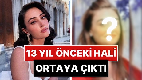 Eski Fotoğrafı Ortaya Çıkan Esra Bilgiç'in Değişimi Gündem Oldu