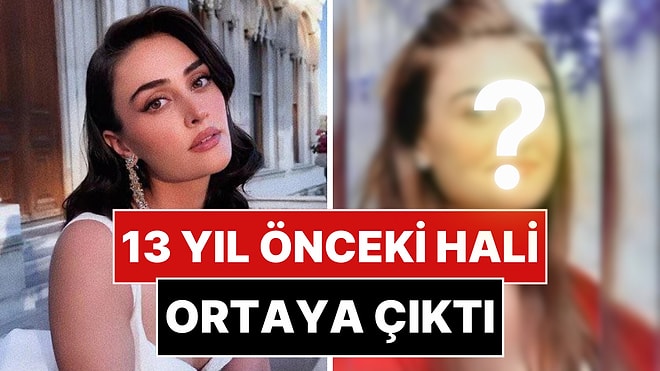 Eski Fotoğrafı Ortaya Çıkan Esra Bilgiç'in Değişimi Gündem Oldu