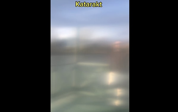 Peki bu hastalıklar görmeyi neden bu şekilde etkiliyor?