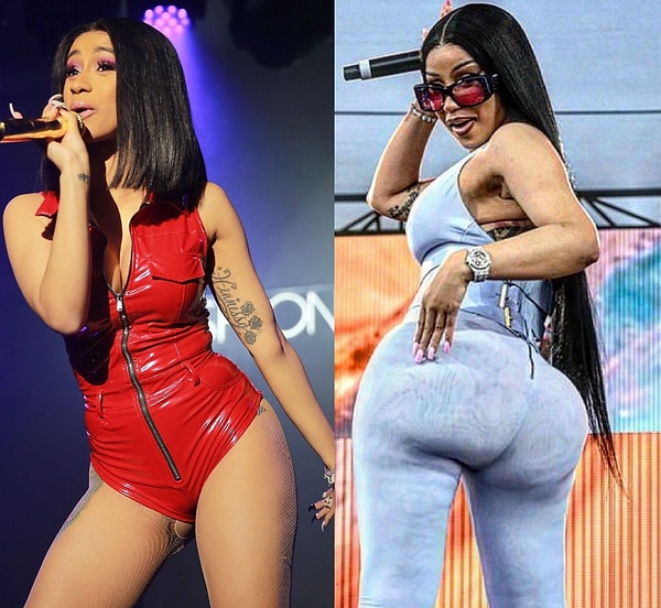 Cardi B, yıllardır vücuduna yaptırdığı estetik işlemleri saklamadan anlatan ender ünlülerden.