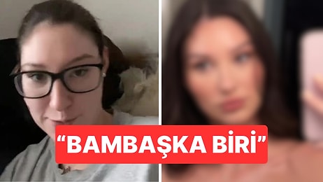 Botoks Sonrası Değişimini Paylaşan Kadın Gündem Oldu