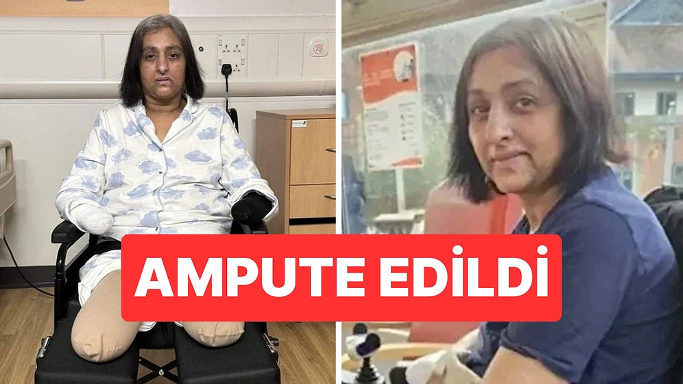 Köpeğinin Teması Sonrası Ağır Enfeksiyon Geçiren Kadın Dört Uzvunu Kaybetti