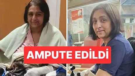 Köpeğinin Teması Sonrası Ağır Enfeksiyon Geçiren Kadın Dört Uzvunu Kaybetti