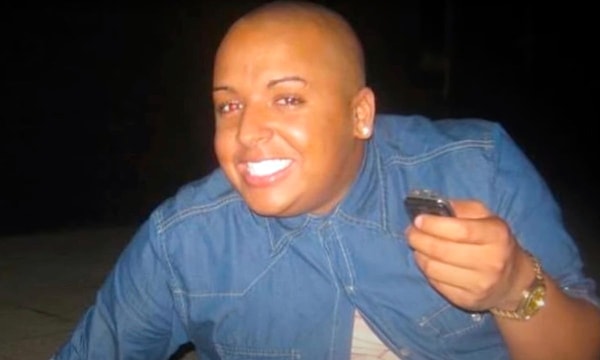 Jordan James Park, özellikle Kim Kardashian’a olan hayranlığı ve geçirdiği estetik operasyonlarla kamuoyunun dikkatini çekmişti.