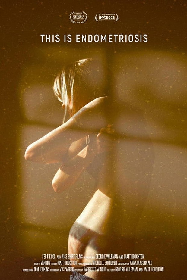 This Is Endometriosis Posteri