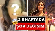 Yüz Nakli Yaptıran Didem Ceran, Yüzünün 21 Gün Sonra Geldiği Hali Paylaştı!