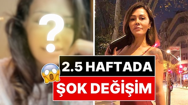 Yüz Nakli Yaptıran Didem Ceran Son Halini Paylaştı!