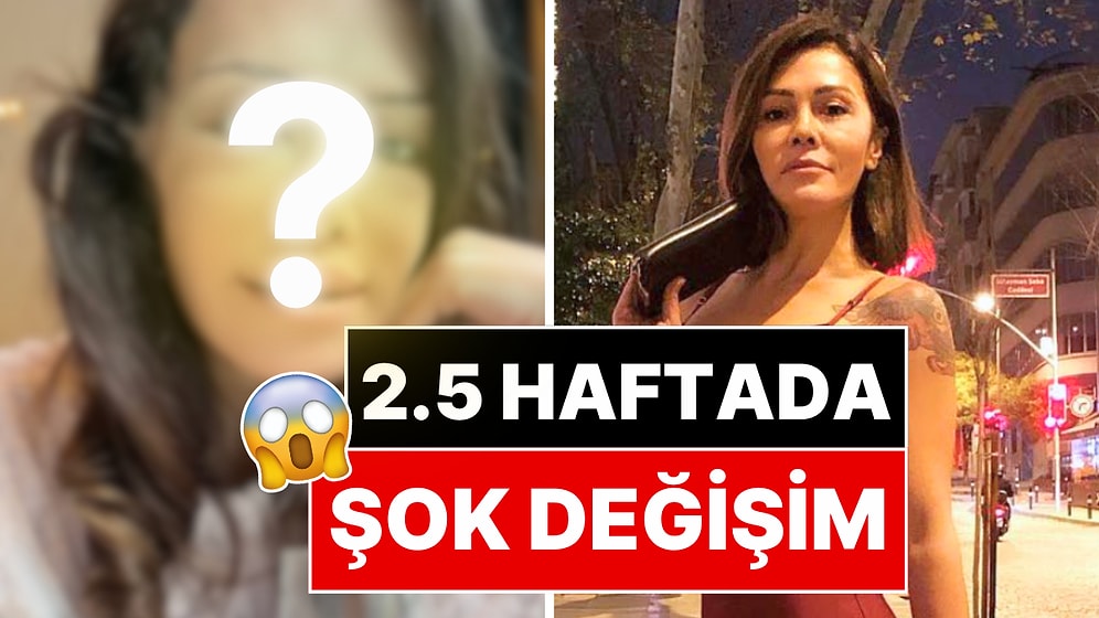 Yüz Nakli Yaptıran Didem Ceran, Yüzünün 21 Gün Sonra Geldiği Hali Paylaştı!
