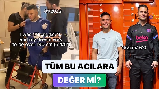 Boy Uzatma Operasyonu Geçiren Bir Adam Yaşadığı Tüm Süreci Paylaştı
