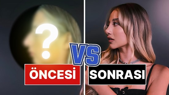 Doktoru, Aleyna Kalaycıoğlu'nun Burun Ameliyatından Önceki ve Sonraki Halini Paylaştı!